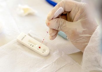 FMS abre agendamento para testes de covid nesta sexta, dia 4