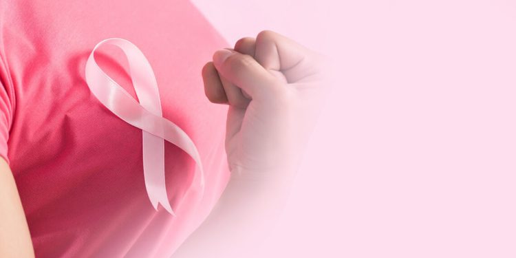 Rede Feminina: a força da mulher em prol da luta contra o câncer