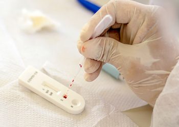 Índice de testes positivos para Covid volta a crescer no Piauí, aponta Fiocruz