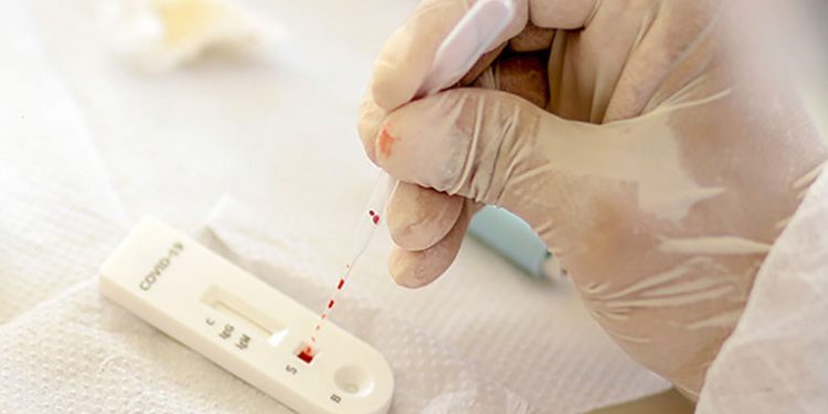 Índice de testes positivos para Covid volta a crescer no Piauí, aponta Fiocruz