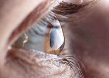 “Junho Violeta”: Coçar os olhos pode levar a defeitos na visão