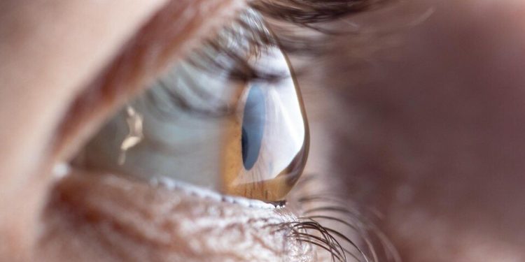“Junho Violeta”: Coçar os olhos pode levar a defeitos na visão